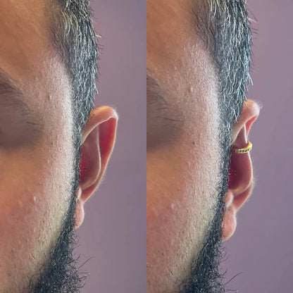 Earfix – Brinco reutilizável que ajuda a harmonizar o rosto de forma natural